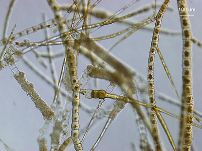 図10 フェオシフォニエラ藻体の顕微鏡写真．