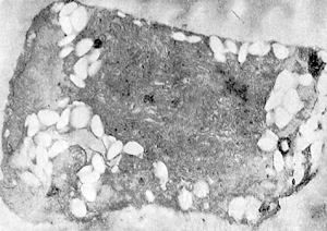 写真3　色落ちしたスサビノリ葉状体の細胞の電子顕微鏡写真