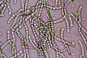 顕微鏡で見た髪菜の藻糸